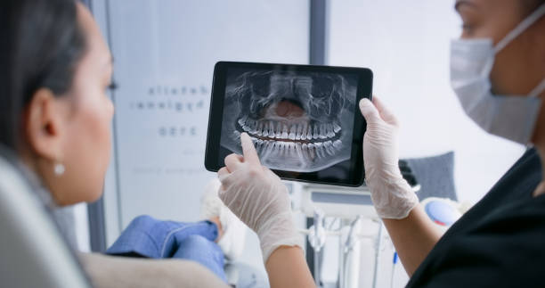 Licensed Tooth Extraction service in Frankfort, IN - Smile Center Dentistry